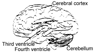 Brain and hydrocephalus