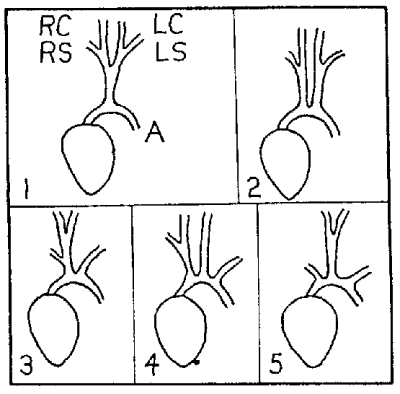 Mammalian aortic arch in the heart